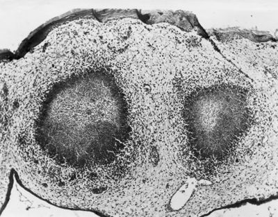 Tubercolosi aviaria sulla membrana corion allantoidea dei polli