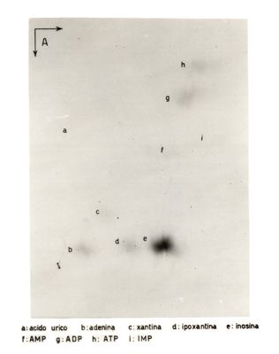 Studio relativo a sostanze trattate con solventi (in esito ad analisi cromatografiche) - a: acido urico; b: adenina; c: xantina; d: ipoxantina; e: inosina; f: AMP; g: ADP; h: ATP; i: IMP