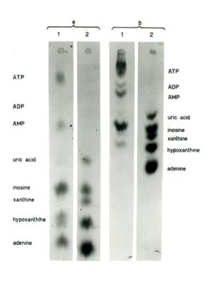 Studio relativo a sostanze trattate con solventi (in esito ad analisi cromatografiche) - a: acido urico; b: adenina; c: xantina; d: ipoxantina; e: inosina; f: AMP; g: ADP; h: ATP; i: IMP