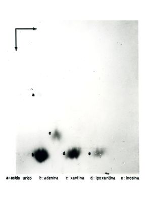 Studio relativo a sostanze trattate con solventi (in esito ad analisi cromatografiche) - a: acido urico; b: adenina; c: xantina; d: ipoxantina; e: inosina