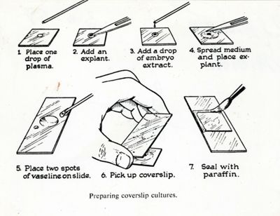 Schema di preparazione di un vetrino per microscopio