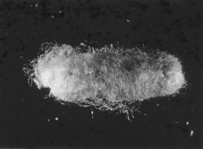 Sacco ovigeno di Latrodectus e differenti tipologie di bozzoli di parassiti