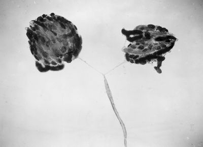 Ginandromorfo di Mosca domestica con gonadi femminili e dotti maschili