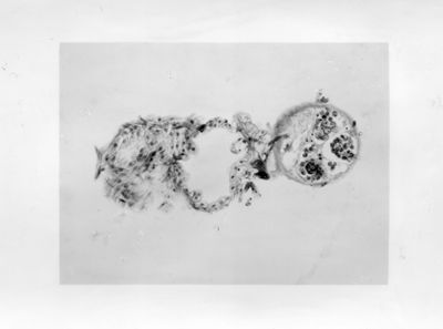 Sezione di un testicolo articolato ad un ovidutto, gonadi con epitelio esterno di sesso opposto ai prodotti sessuali, sezione di 2 gonadi di sesso opposto, immature e articolate a ovidutti